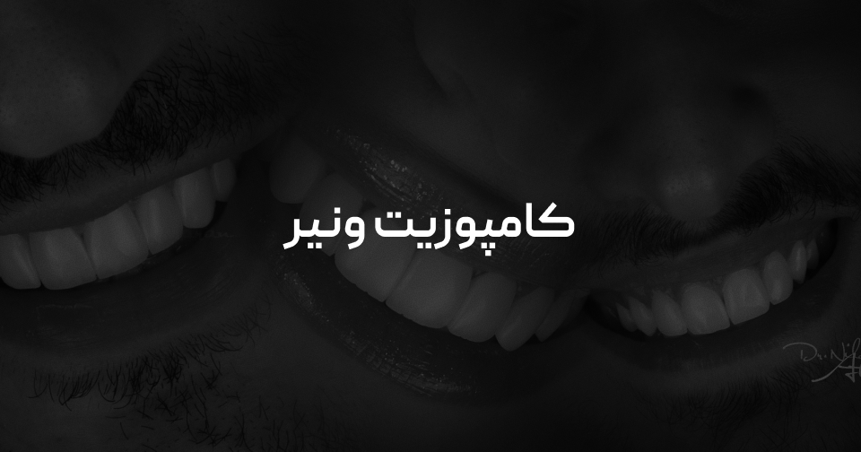 کامپوزیت در رش