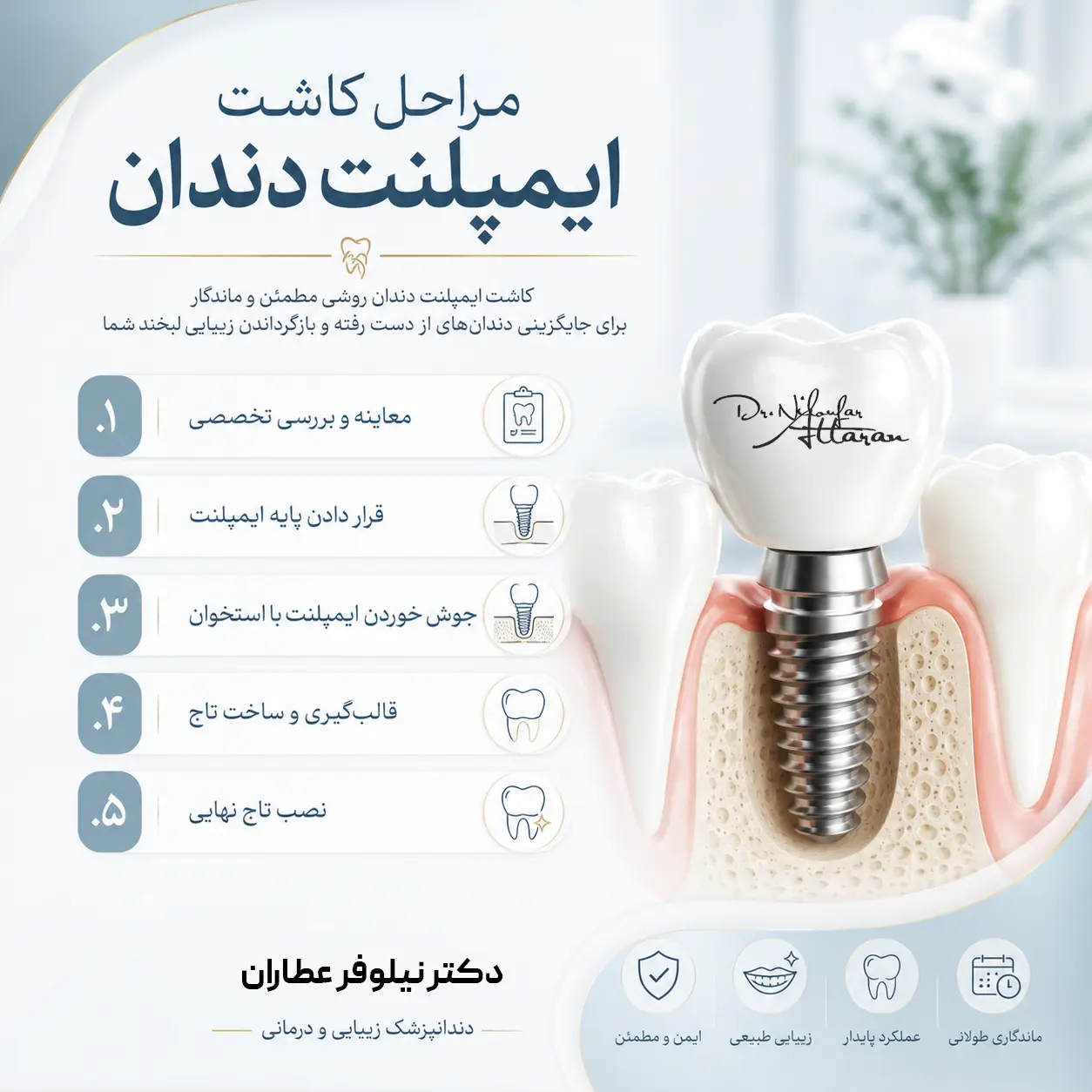 ایمپلنت دندان در رشت دکتر نیلوفر عطاران دندانپزشک در رشت