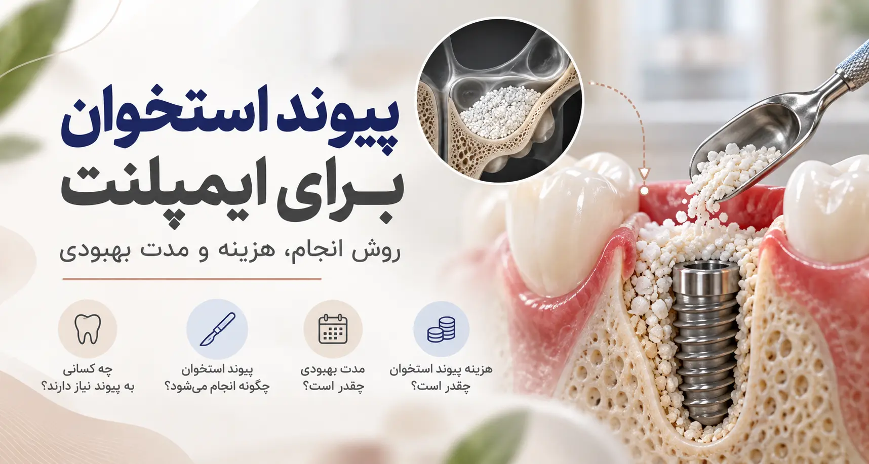 پیوند استخوان برای ایمپلنت؛ روش انجام، هزینه و مدت بهبودی