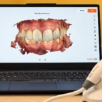 اسکن دیجیتال دندانپزشکی دیجیتال در رشت