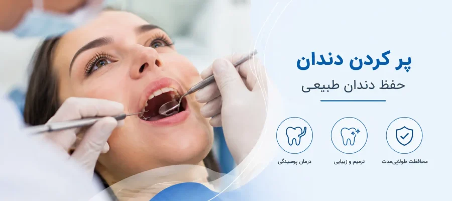 پر کردن دندان در رشت بهترین دکتر برای پر کردن دندان